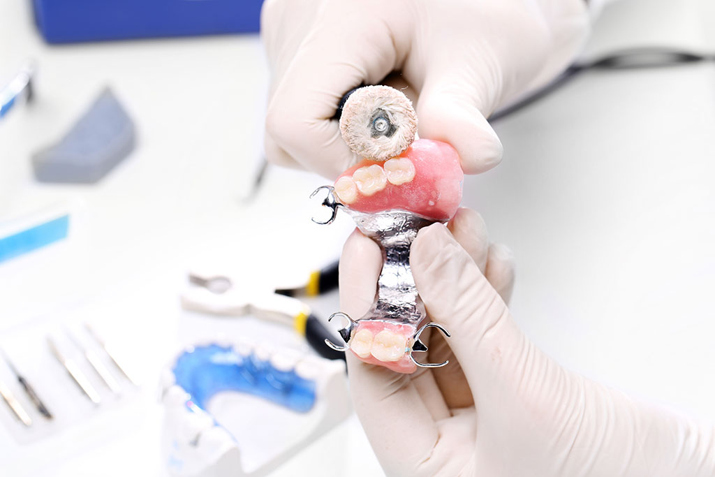 نحوه ساخت پروتز دندان