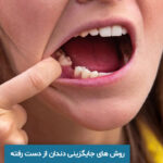 روش‌ های جایگزینی دندان از دست‌ رفته
