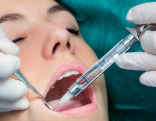 تزریق بی حسی در دندانپزشکی