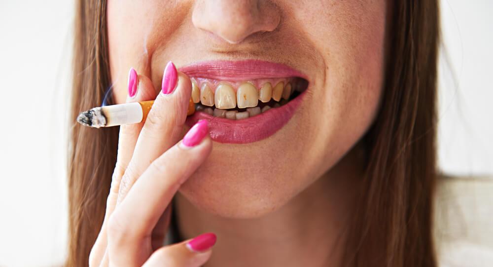 سیگار کشیدن موجب تغییر رنگ دندان ها می شود