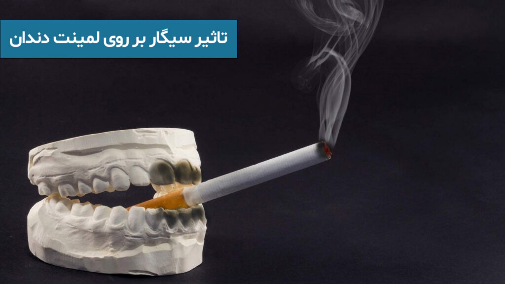 تاثیر سیگار بر روی لمینت دندان