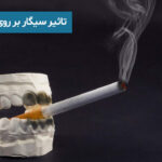 تاثیر سیگار بر روی لمینت دندان