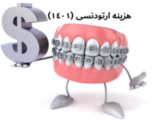هزینه ارتودنسی