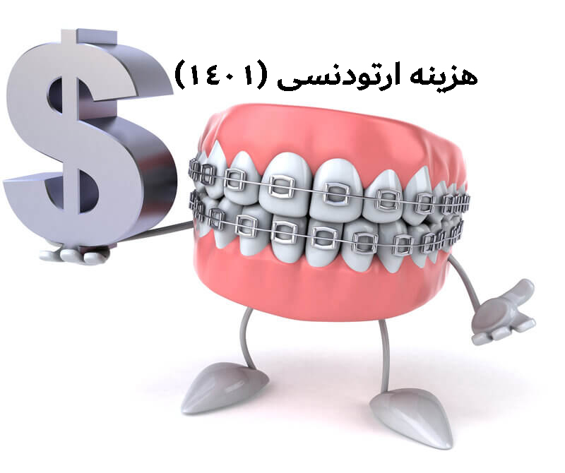هزینه ارتودنسی