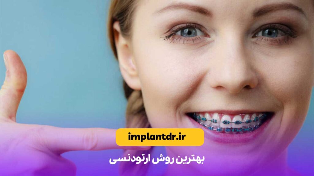 بهترین روش ارتودنسی