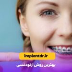 بهترین روش ارتودنسی