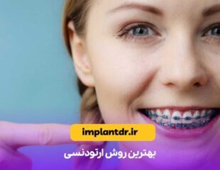 بهترین روش ارتودنسی