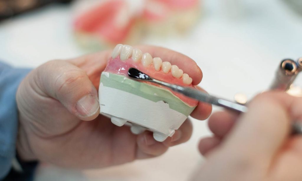 نحوه ساخت دندان مصنوعی ژله ای