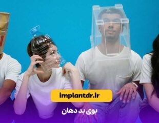 بوی بد دهان