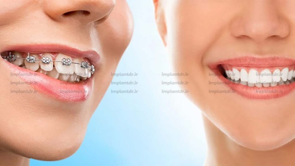 بررسی نمونه کارها 