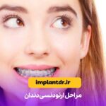 مراحل ارتودنسی دندان
