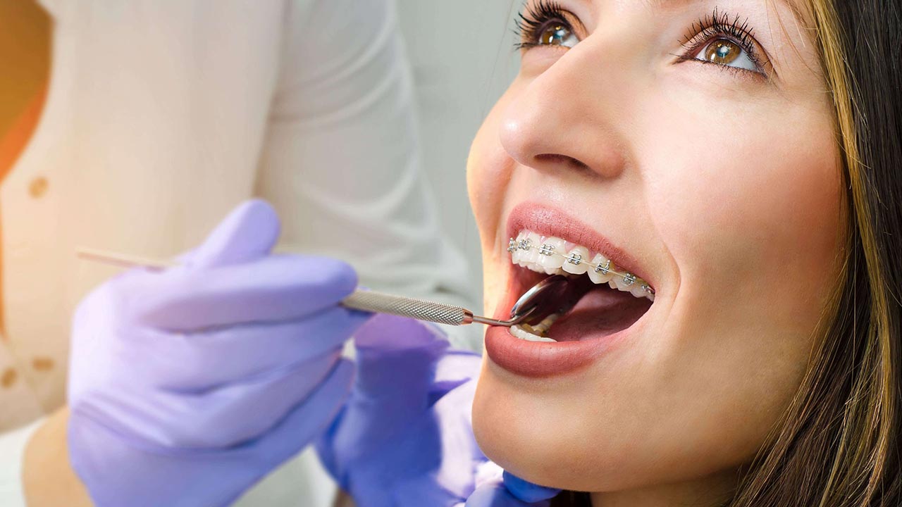 ارتودنسی دندان بزرگسالان بیشتر از کودکان طول می کشد.