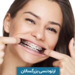 ارتودنسی بزرگسالان