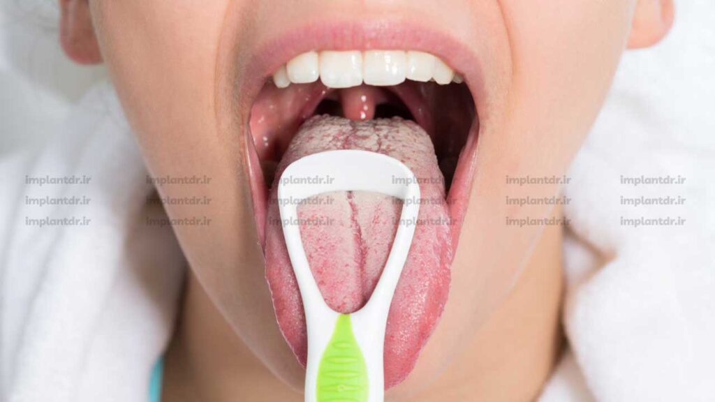 بهداشت زبان