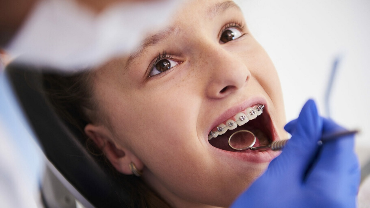 معاینه ارتودنسی ثابت دندان کودک توسط متخصص ارتودنسی