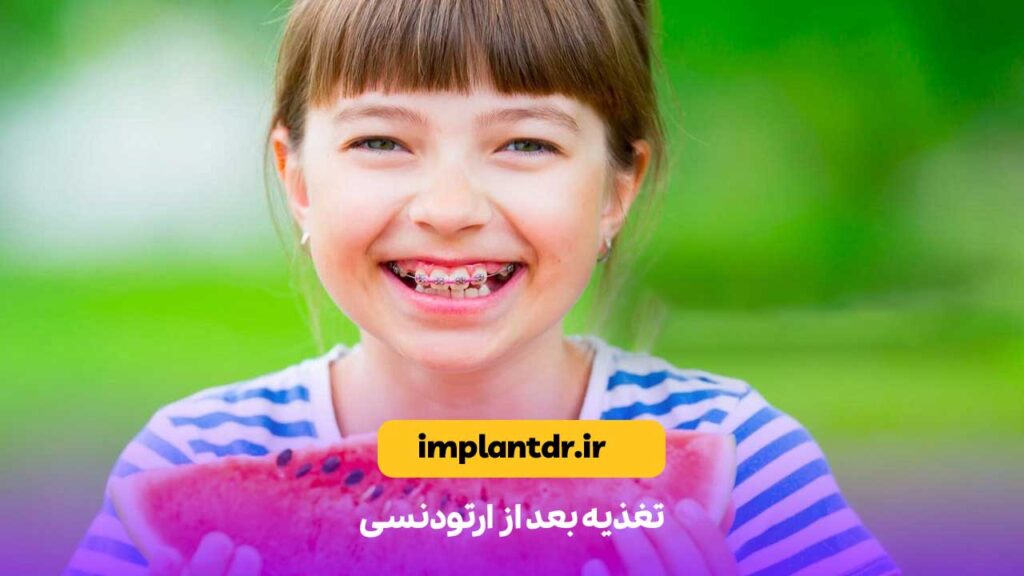تغذیه بعد از ارتودنسی