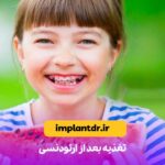 تغذیه بعد از ارتودنسی