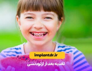 تغذیه بعد از ارتودنسی