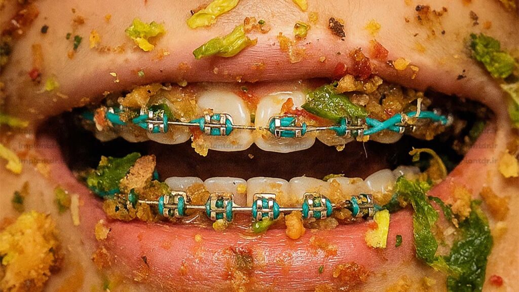 تغذیه بعد از ارتودنسی