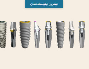 بهترین ایمپلنت دندان