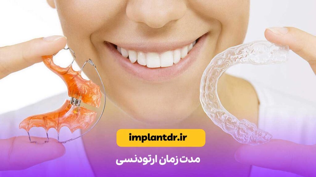 مدت زمان ارتودنسی