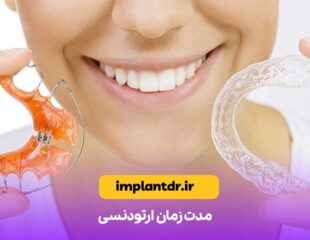 مدت زمان ارتودنسی