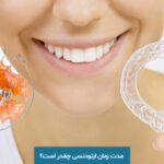 مدت زمان ارتودنسی