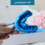 قالب گیری ارتودنسی