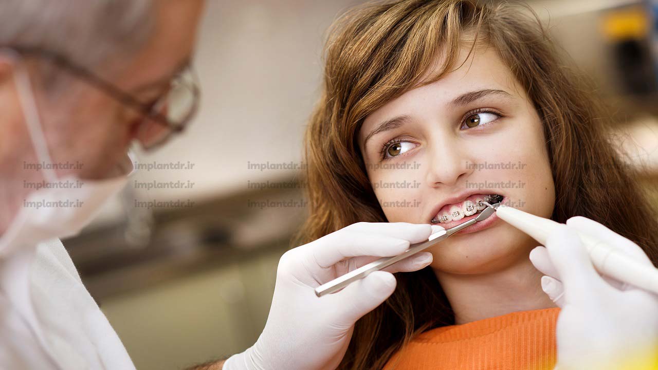 ارتودنسی نوجوانان