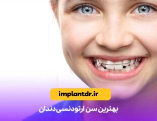 بهترین سن ارتودنسی دندان