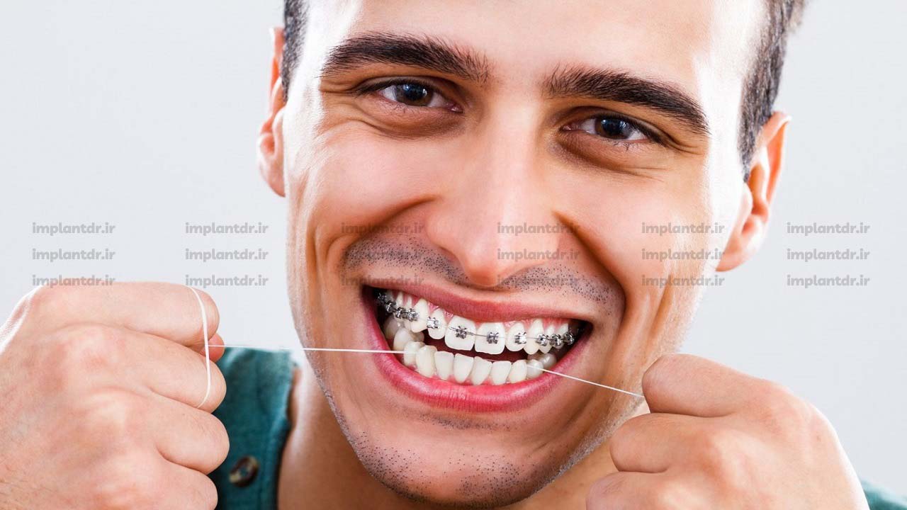 ارتودنسی بزرگسالان