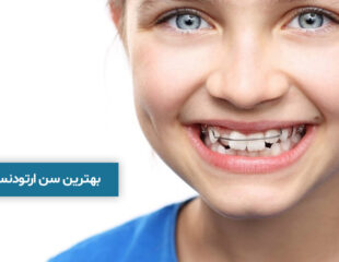 بهترین سن ارتودنسی دندان