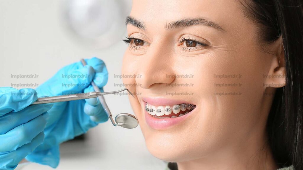 روند درمان ارتودنسی توسط متخصص