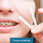 موم ارتودنسی