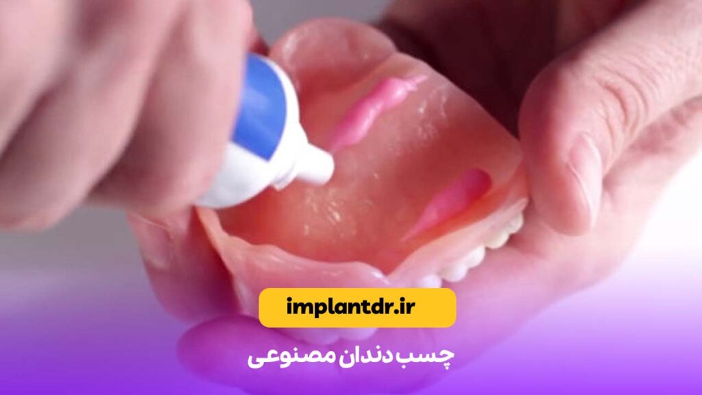 چسب دندان مصنوعی