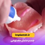 چسب دندان مصنوعی