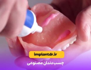 چسب دندان مصنوعی