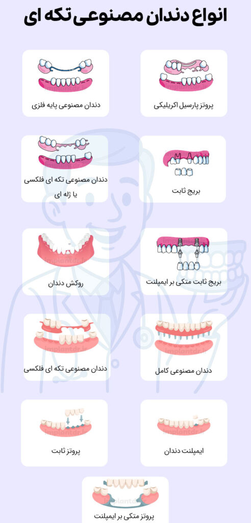 انواع دندان مصنوعی تکه ای