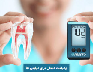 ایمپلنت دندان برای دیابتی ها
