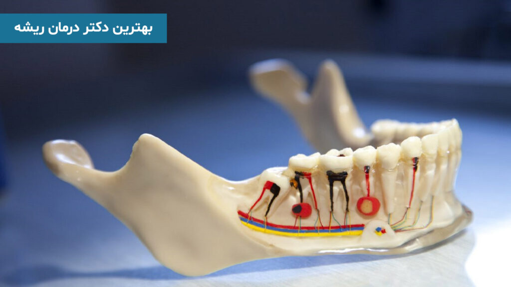 بهترین دکتر درمان ریشه