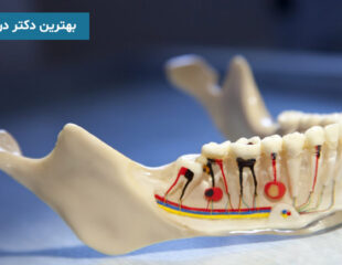 بهترین دکتر درمان ریشه
