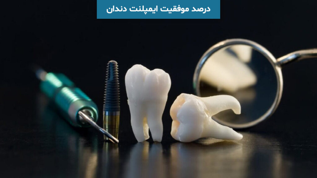 درصد موفقیت ایمپلنت دندان