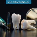 درصد موفقیت ایمپلنت دندان