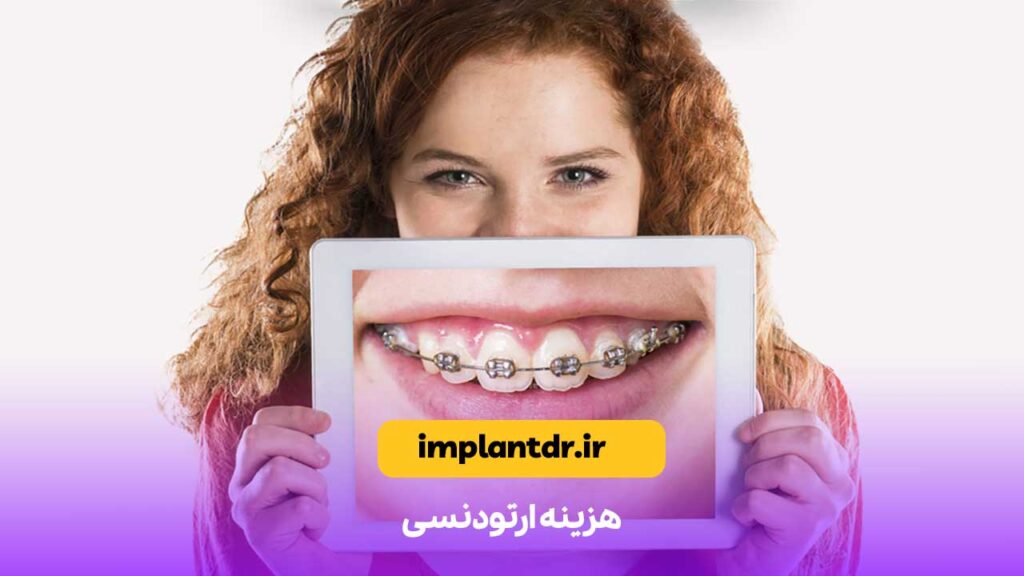 هزینه ارتودنسی