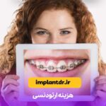 هزینه ارتودنسی