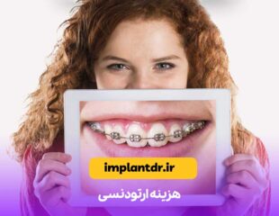 هزینه ارتودنسی