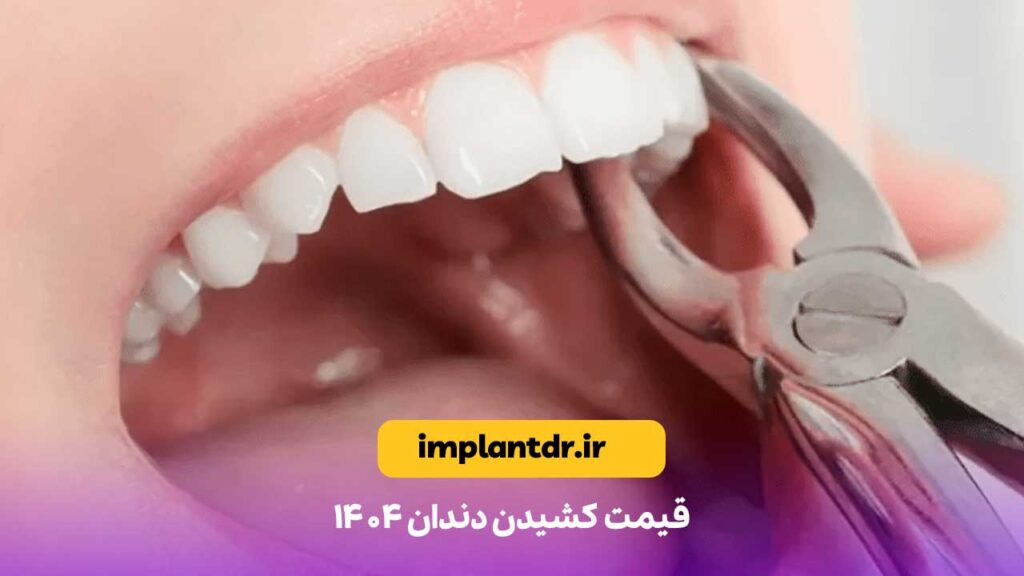 قیمت کشیدن دندان