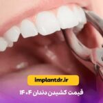 قیمت کشیدن دندان