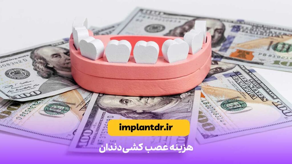 هزینه عصب کشی دندان