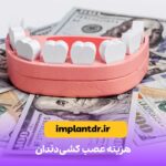 هزینه عصب کشی دندان